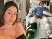 Bella mujer quedó paralizada por tomar una sopa instantánea